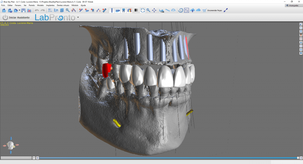 Implantodontia Dental Harmony